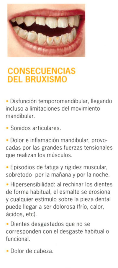 Férula o Placa de Descarga y Bruxismo - Clínica Dental Mirasierra